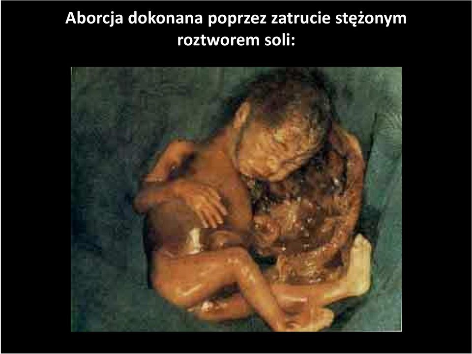 poprzez