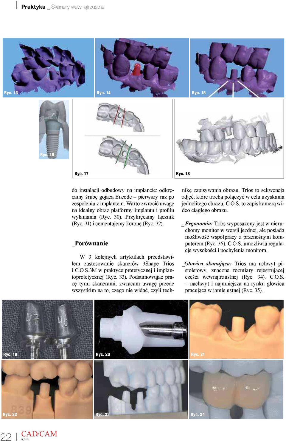 _Porównanie W 3 kolejnych artykułach przedstawiłem zastosowanie skanerów 3Shape Trios i C.O.S.3M w praktyce protetycznej i implantoprotetycznej (Ryc. 33).