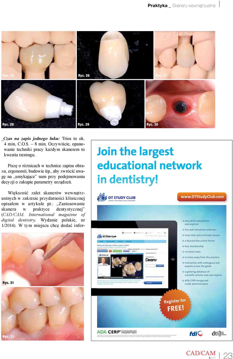 Większość zalet skanerów wewnątrzustnych w zakresie przydatności klinicznej opisałem w artykule pt.: Zastosowanie skanera w praktyce dentystycznej (. International magazine of digital dentistry.