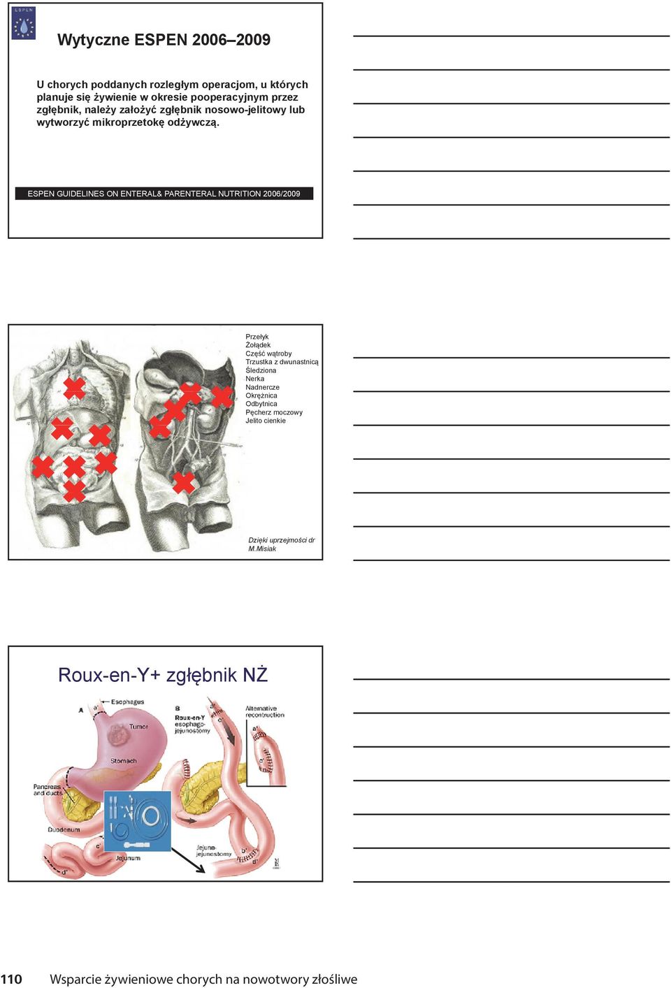 ESPEN GUIDELINES ON ENTERAL& PARENTERAL NUTRITION 2006/2009 Przełyk Żołądek Część wątroby Trzustka z dwunastnicą Śledziona Nerka Nadnercze