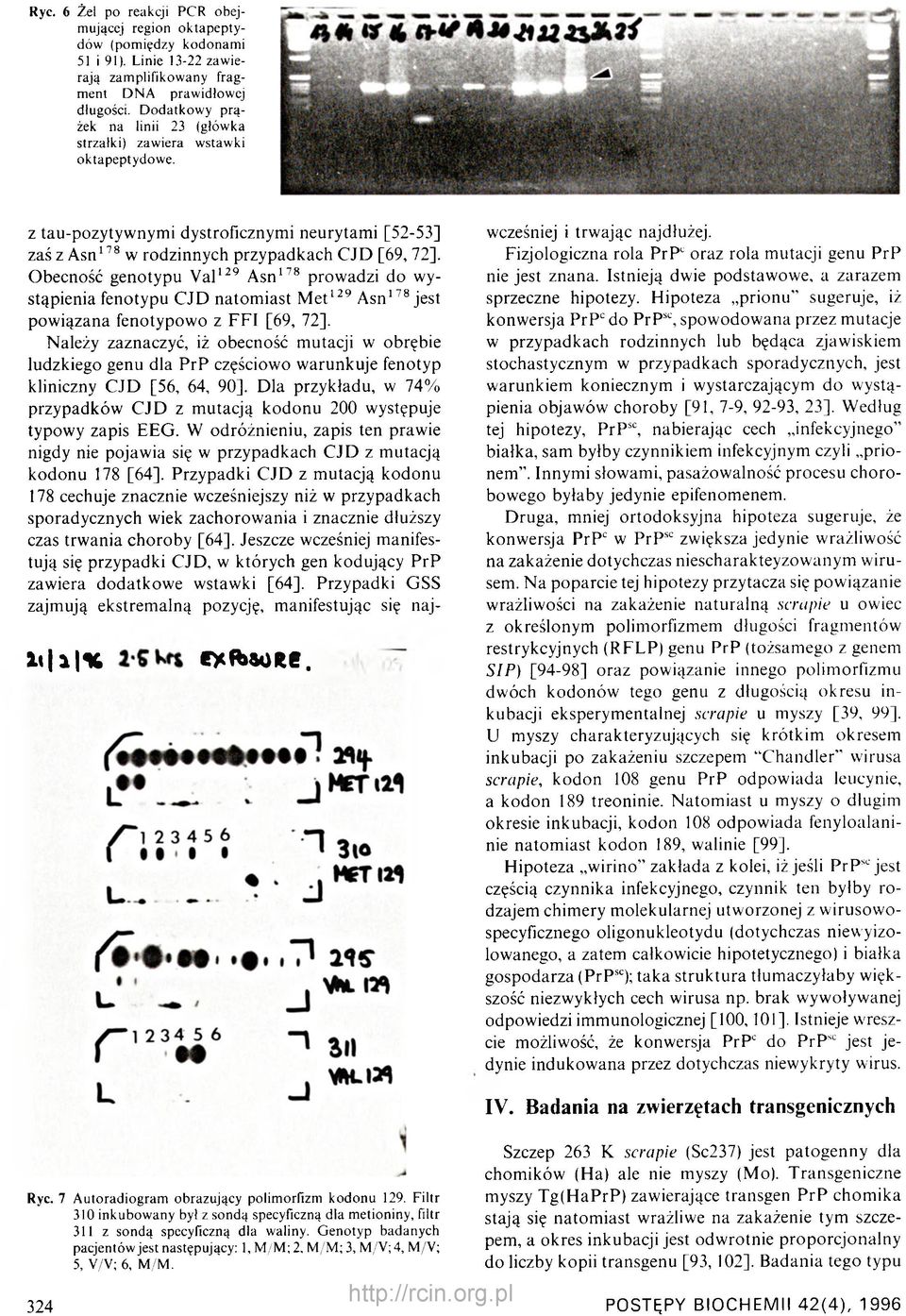 z tau-pozytywnymi dystroficznymi neurytami [52-53] zaś z Asn178 w rodzinnych przypadkach CJD [69, 72], Obecność genotypu Val129 Asn178 prowadzi do wystąpienia fenotypu CJD natomiast M et129 Asn178