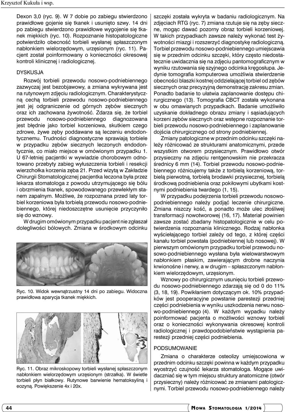 Pacjent został poinformowany o konieczności okresowej kontroli klinicznej i radiologicznej.