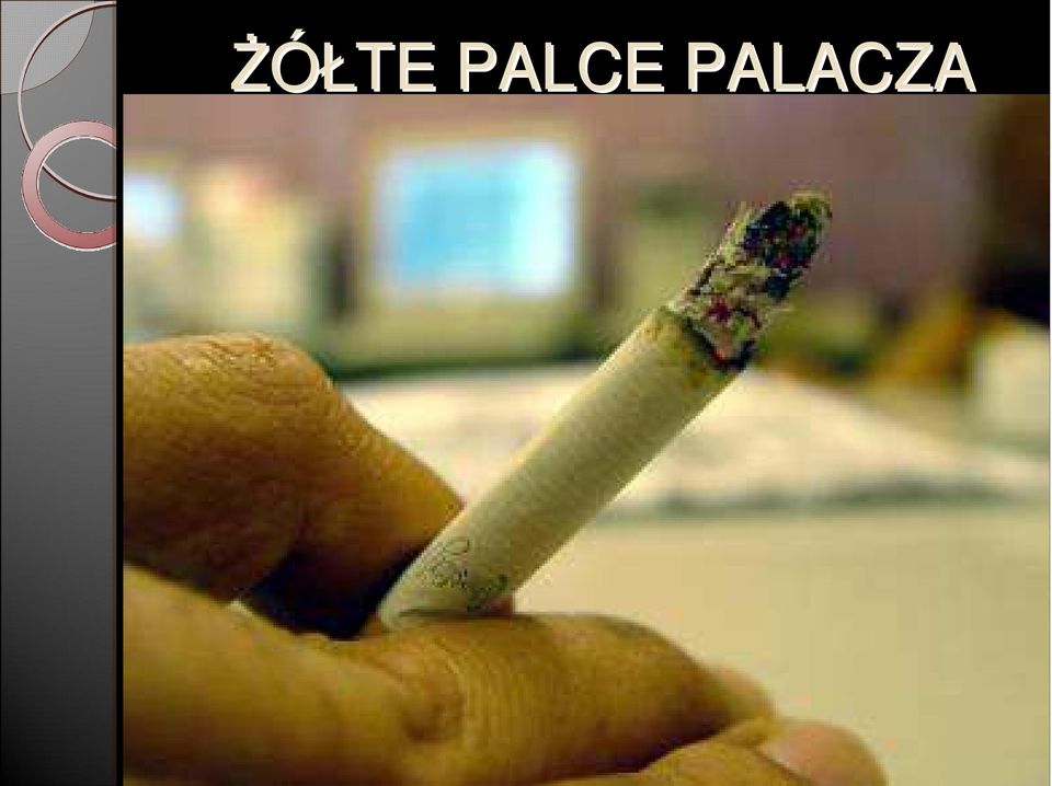 PALACZA