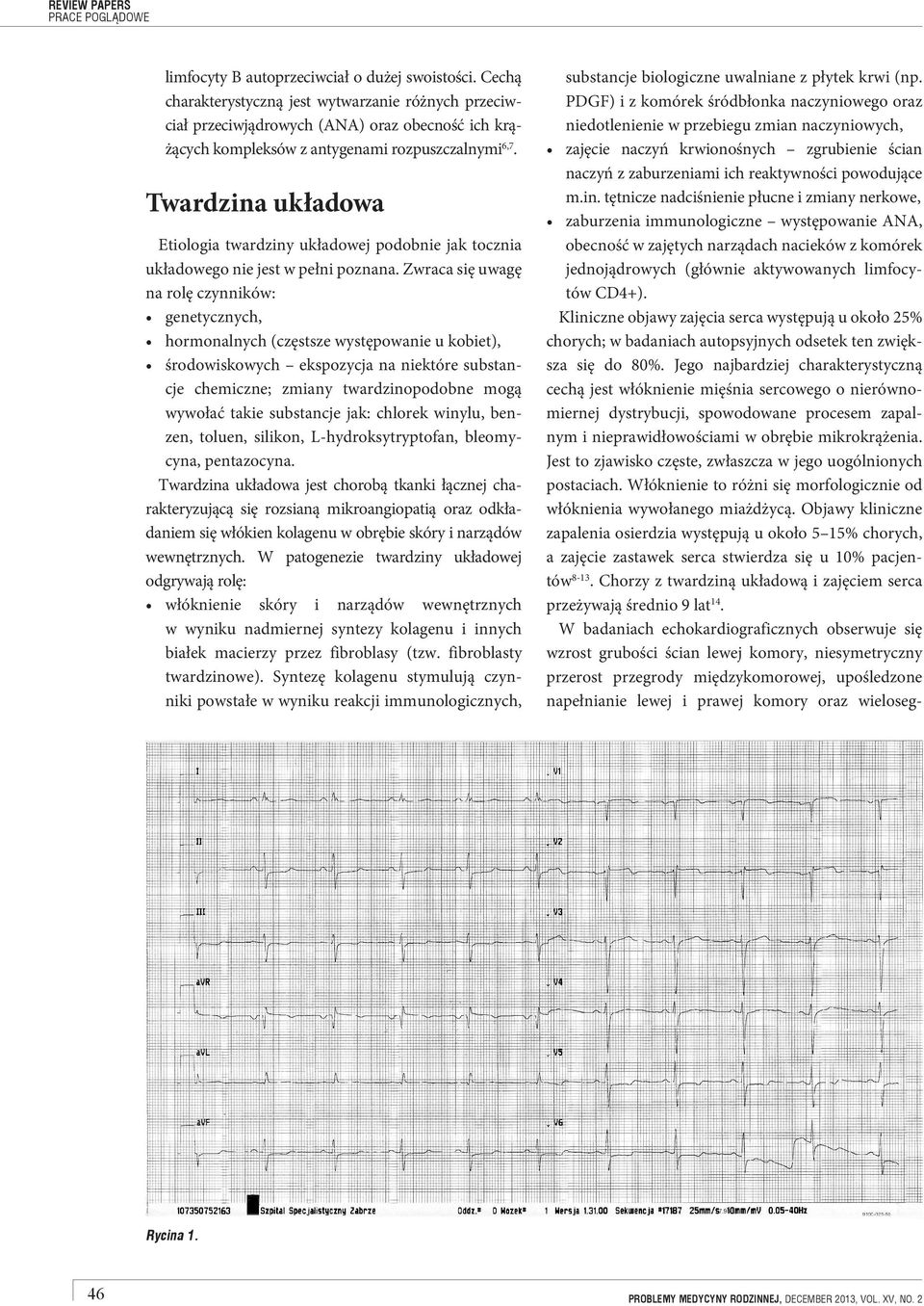 Twardzina układowa Etiologia twardziny układowej podobnie jak tocznia układowego nie jest w pełni poznana.