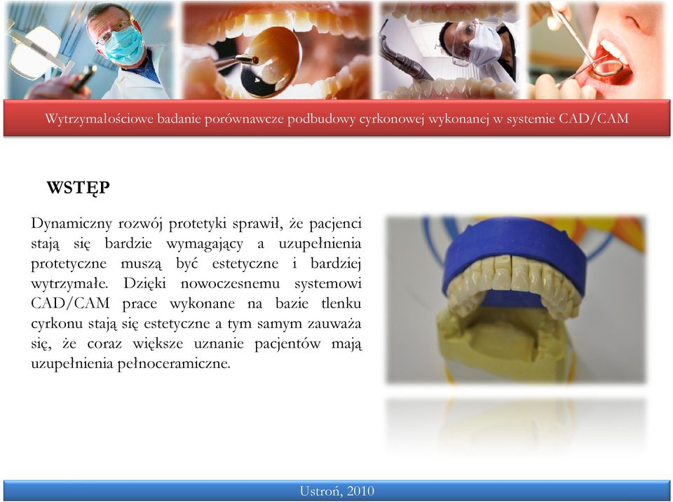 Dzięki nowoczesnemu systemowi CAD/CAM prace wykonane na bazie tlenku cyrkonu stają się
