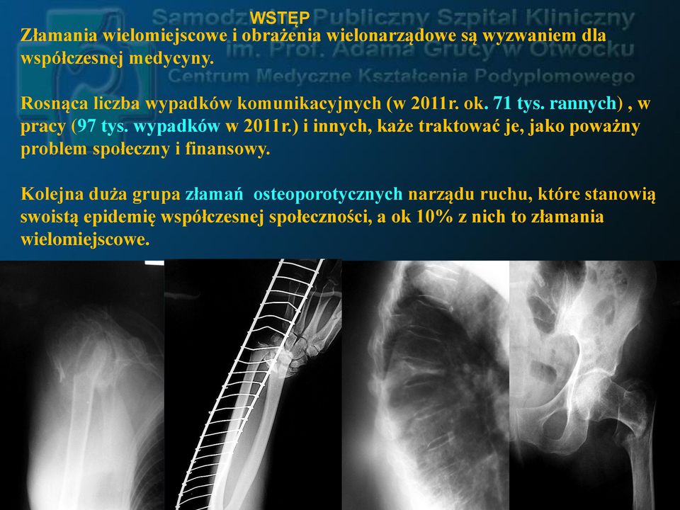 ) i innych, każe traktować je, jako poważny problem społeczny i finansowy.