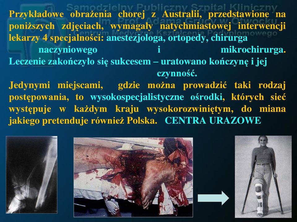 Leczenie zakończyło się sukcesem uratowano kończynę i jej czynność.