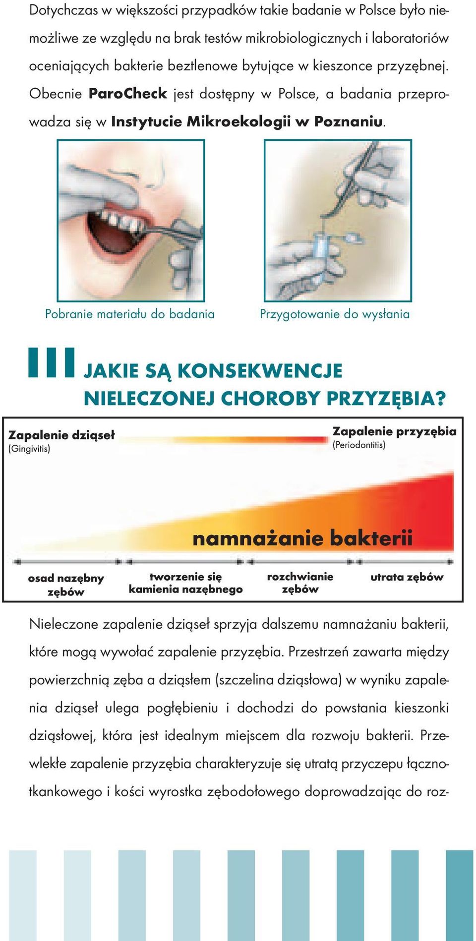 Pobranie materiału do badania Przygotowanie do wysłania JAKIE SĄ KONSEKWENCJE NIELECZONEJ CHOROBY PRZYZĘBIA?