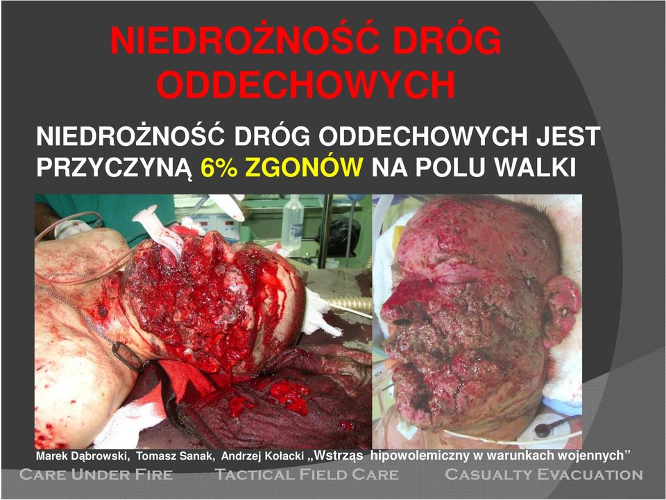 JEST PRZYCZYNĄ 6%