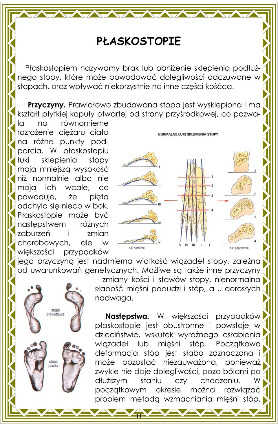 W płaskostopiu łuki sklepienia stopy mają mniejszą wysokość niż normalnie albo nie mają ich wcale, co powoduje, że pięta odchyla się nieco w bok.