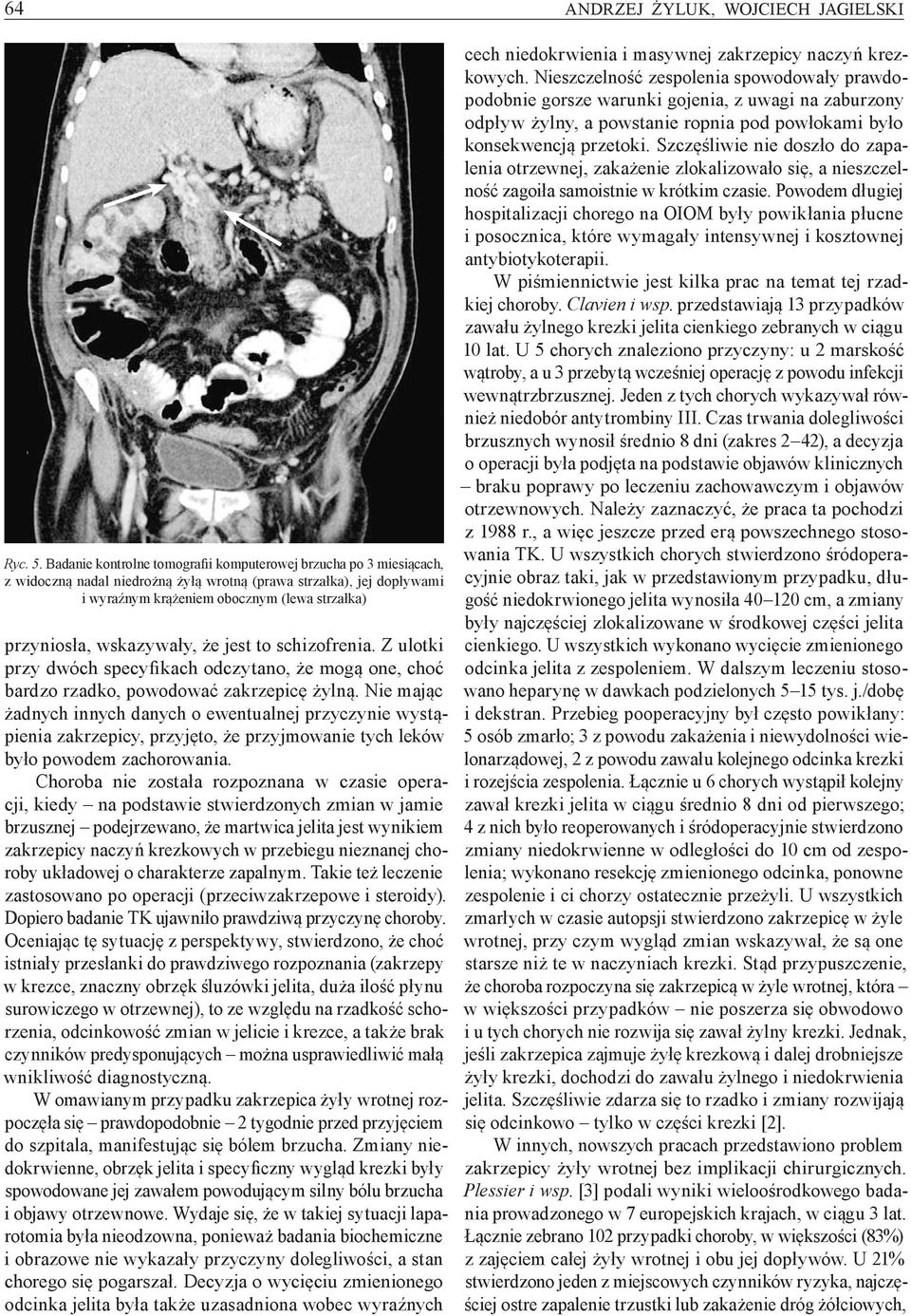 wskazywały, że jest to schizofrenia. Z ulotki przy dwóch specyfikach odczytano, że mogą one, choć bardzo rzadko, powodować zakrzepicę żylną.