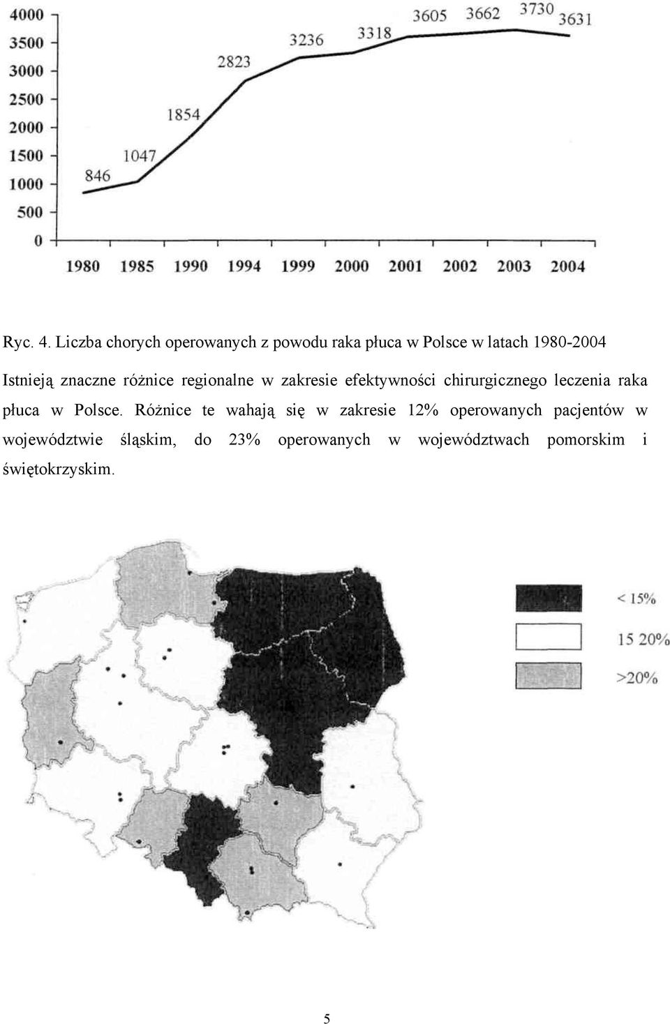 znaczne różnice regionalne w zakresie efektywności chirurgicznego leczenia raka
