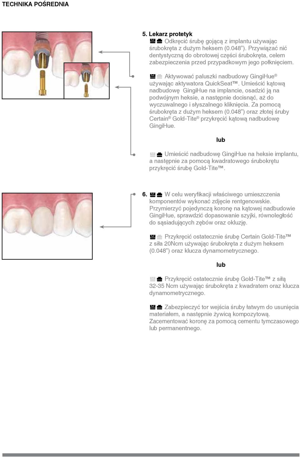 Umieścić kątową nadbudowę GingiHue na implancie, osadzić ją na podwójnym heksie, a następnie docisnąć, aż do wyczuwalnego i słyszalnego kliknięcia. Za pomocą śrubokręta z dużym heksem (0.
