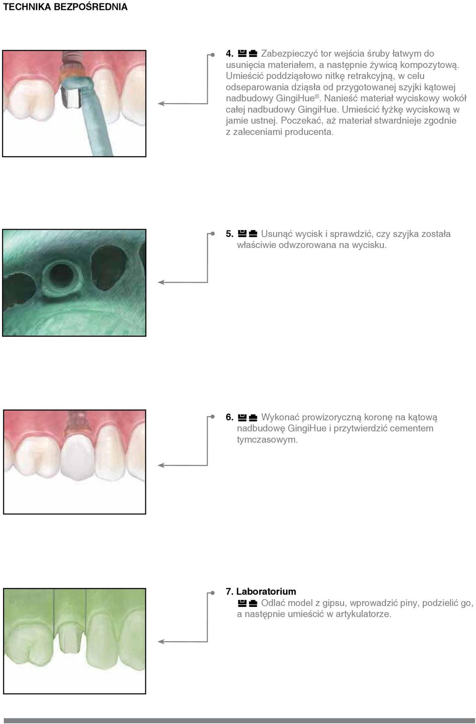 Nanieść materiał wyciskowy wokół całej nadbudowy GingiHue. Umieścić łyżkę wyciskową w jamie ustnej. Poczekać, aż materiał stwardnieje zgodnie z zaleceniami producenta. 5.