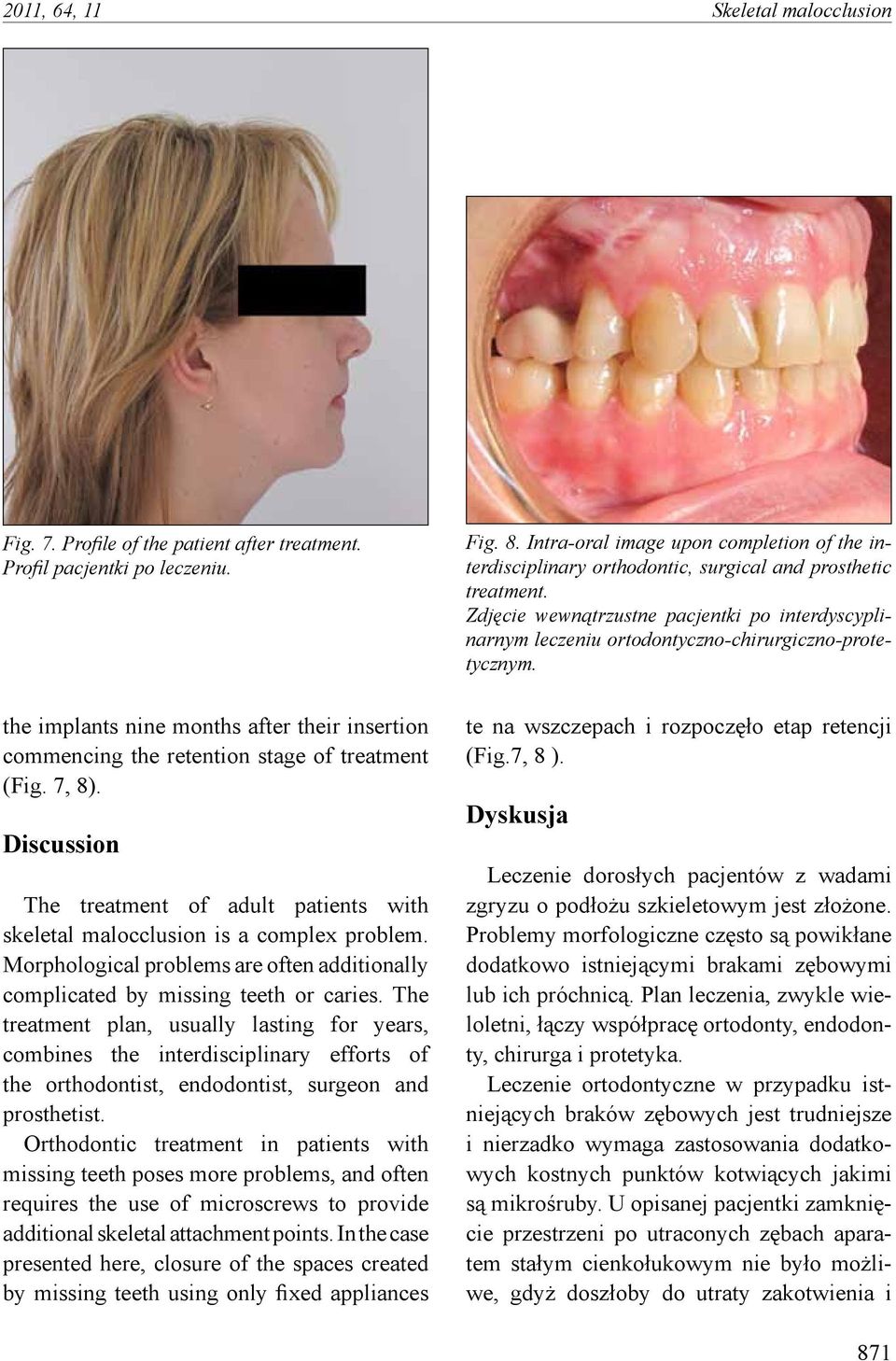 Morphological problems are often additionally complicated by missing teeth or caries.