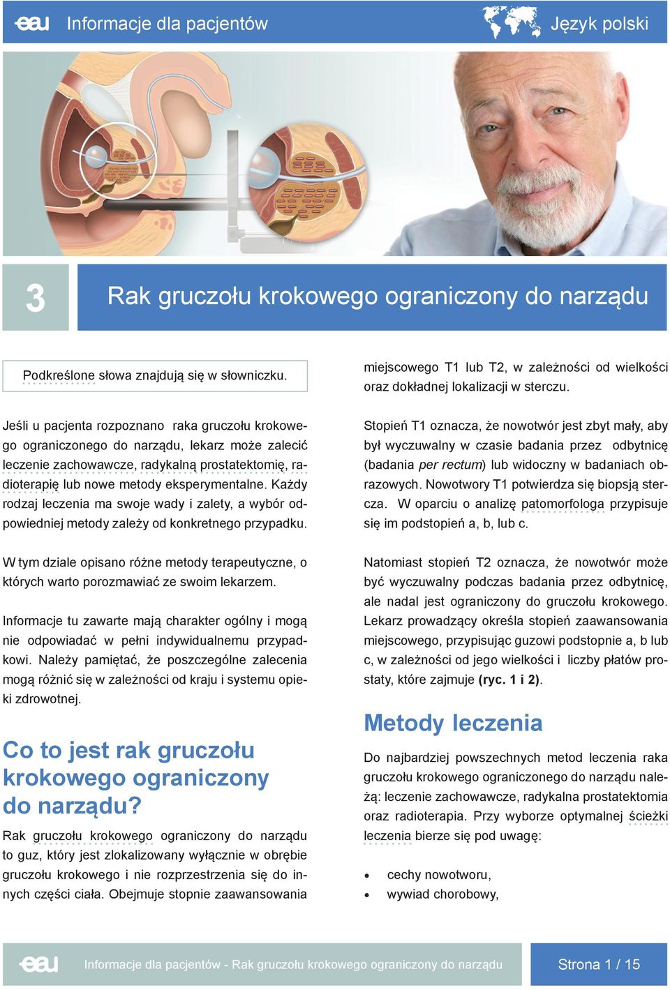 Jeśli u pacjenta rozpoznano raka gruczołu krokowego ograniczonego do narządu, lekarz może zalecić leczenie zachowawcze, radykalną prostatektomię, radioterapię lub nowe metody eksperymentalne.