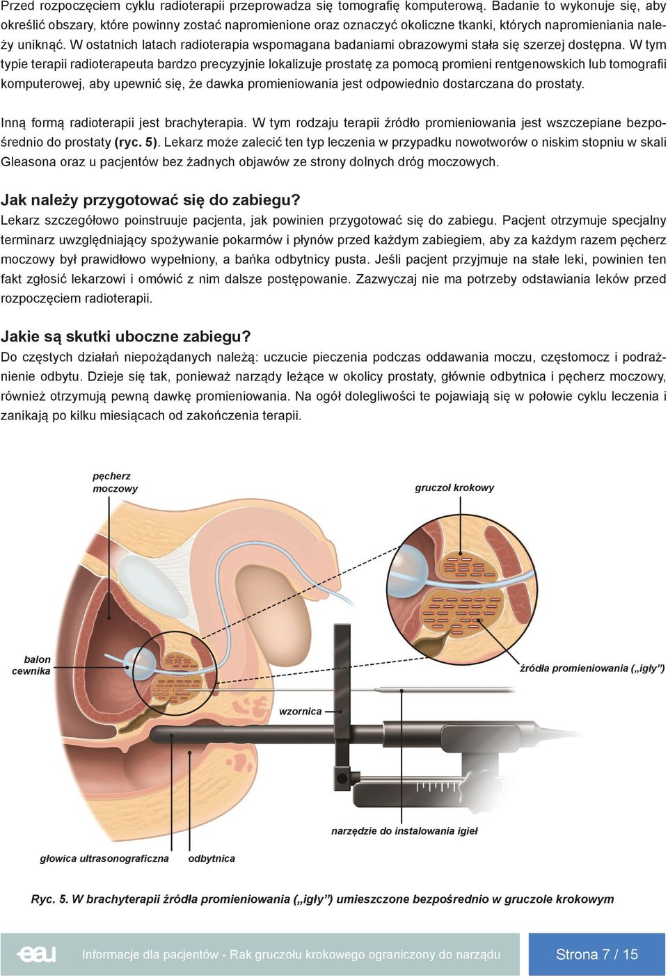 W ostatnich latach radioterapia wspomagana badaniami obrazowymi stała się szerzej dostępna.