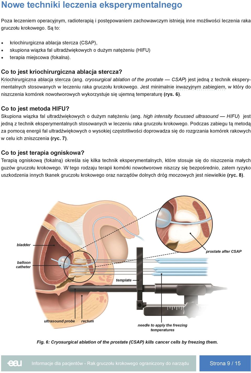 Kriochirurgiczna ablacja stercza (ang. cryosurgical ablation of the prostate CSAP) jest jedną z technik eksperymentalnych stosowanych w leczeniu raka gruczołu krokowego.