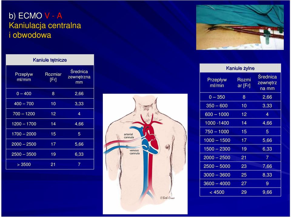 ml/min Kaniule żylne Rozmi ar [Fr[ Fr] Średnica zewnętrz na mm 0 350 8 2,66 350 600 10 3,33 600 1000 12 4 1000-1400 14 4,66