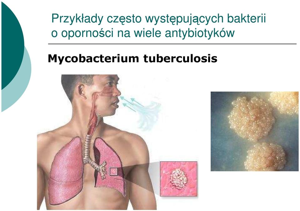 oporności na wiele