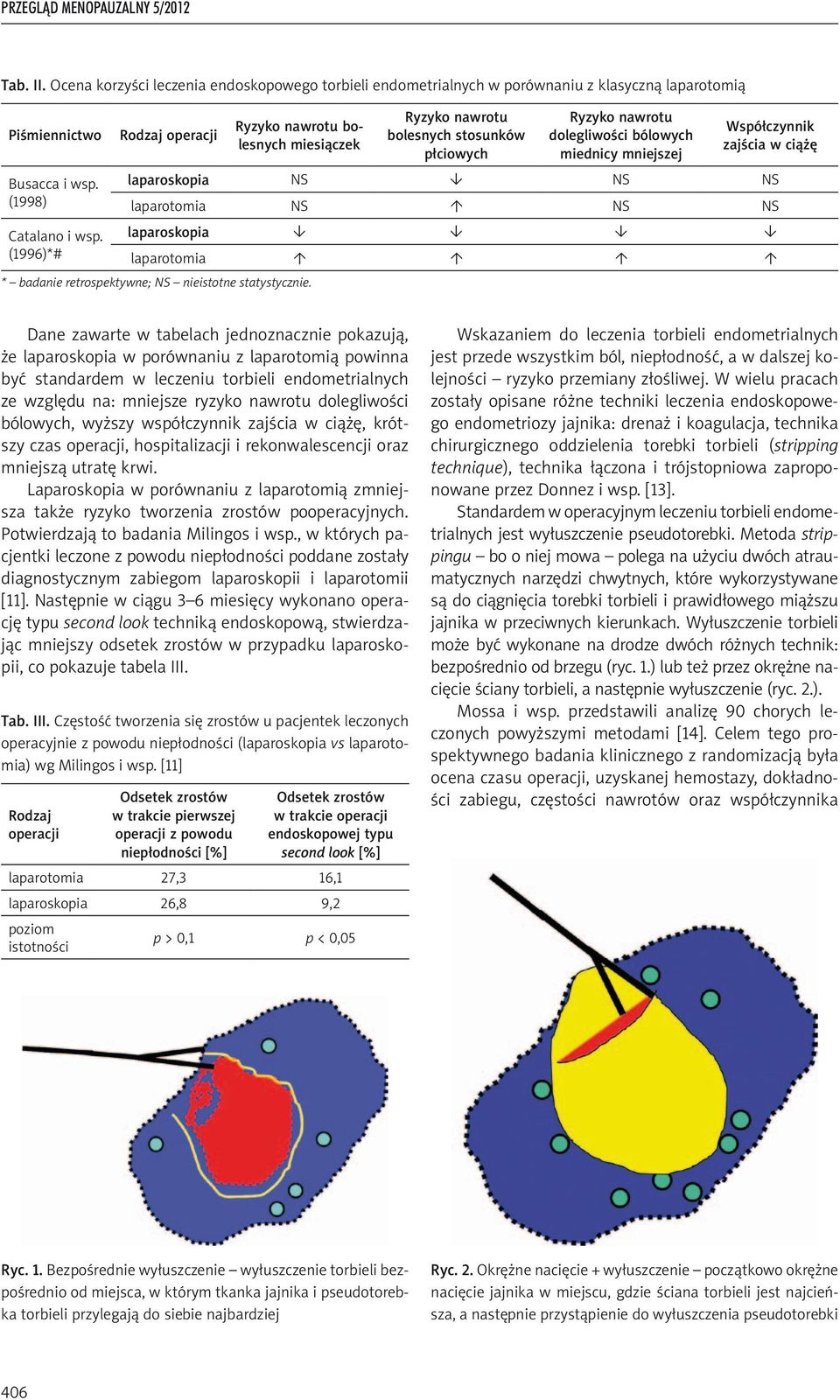 laparoskopia NS NS NS laparotomia NS NS NS Catalano i wsp. laparoskopia (1996)*# laparotomia * badanie retrospektywne; NS nieistotne statystycznie.