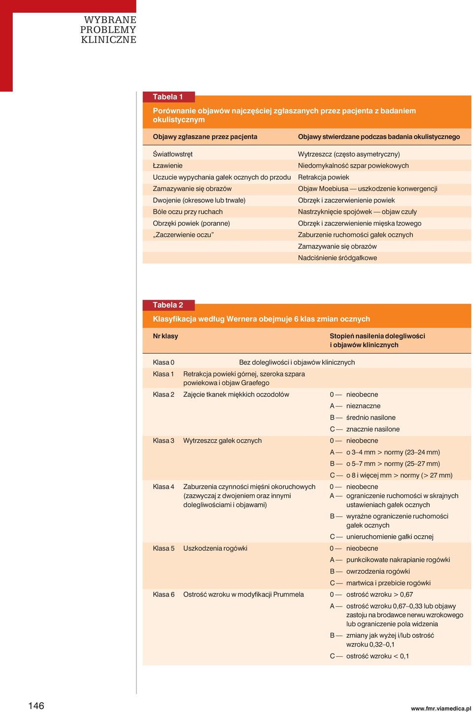 asymetryczny) Niedomykalność szpar powiekowych Retrakcja powiek Objaw Moebiusa uszkodzenie konwergencji Obrzęk i zaczerwienienie powiek Nastrzyknięcie spojówek objaw czuły Obrzęk i zaczerwienienie