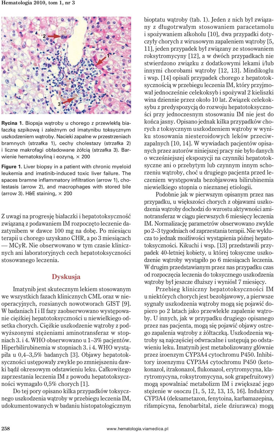 Liver biopsy in a patient with chronic myeloid leukemia and imatinib-induced toxic liver failure.