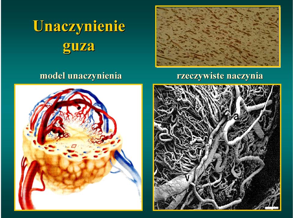 unaczynienia