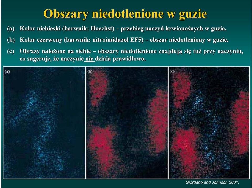 Kolor czerwony (barwnik: nitroimidazol EF5) obszar niedotleniony w guzie.