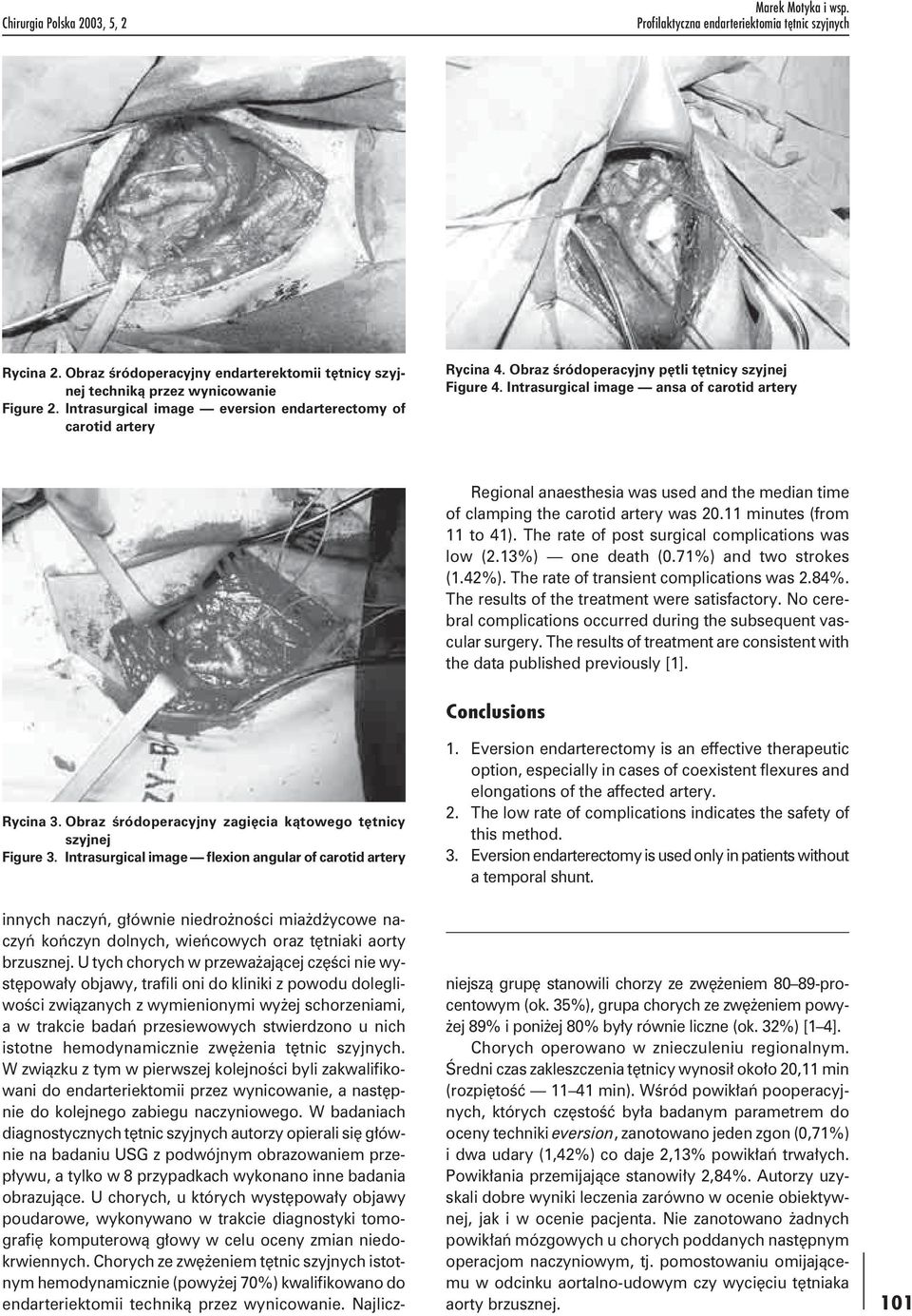 Intrasurgical image ansa of carotid artery Regional anaesthesia was used and the median time of clamping the carotid artery was 20.11 minutes (from 11 to 41).