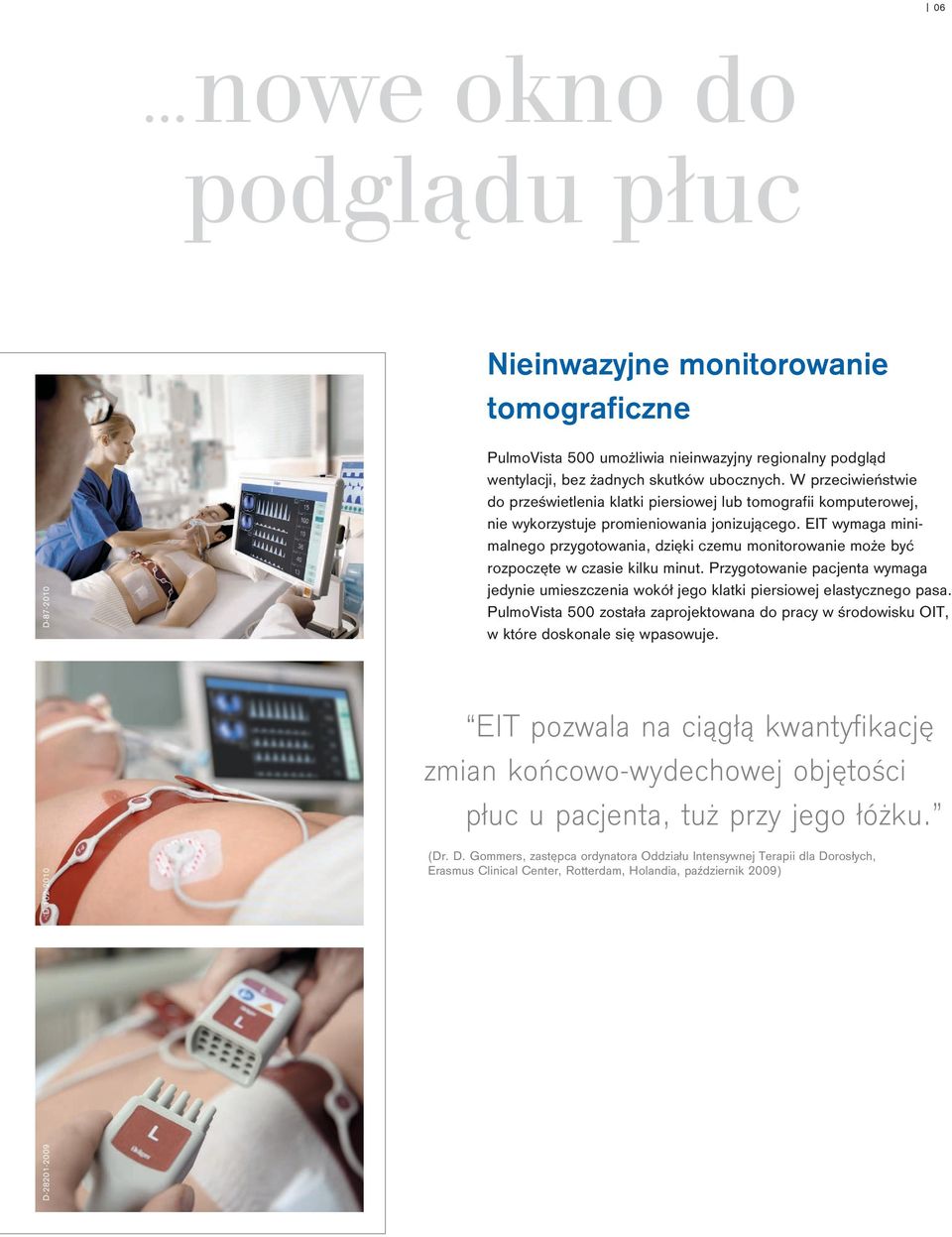 EIT wymaga minimalnego przygotowania, dzięki czemu monitorowanie może być rozpoczęte w czasie kilku minut.