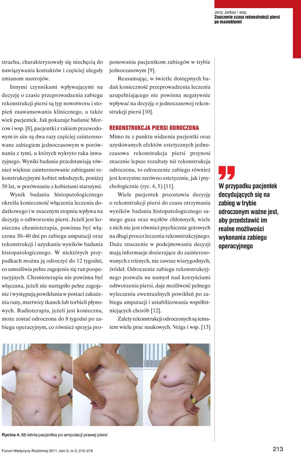 Jak pokazuje badanie Morrow i wsp. [8], pacjentki z rakiem przewodowym in situ są dwa razy częściej zainteresowane zabiegiem jednoczasowym w porównaniu z tymi, u których wykryto raka inwazyjnego.