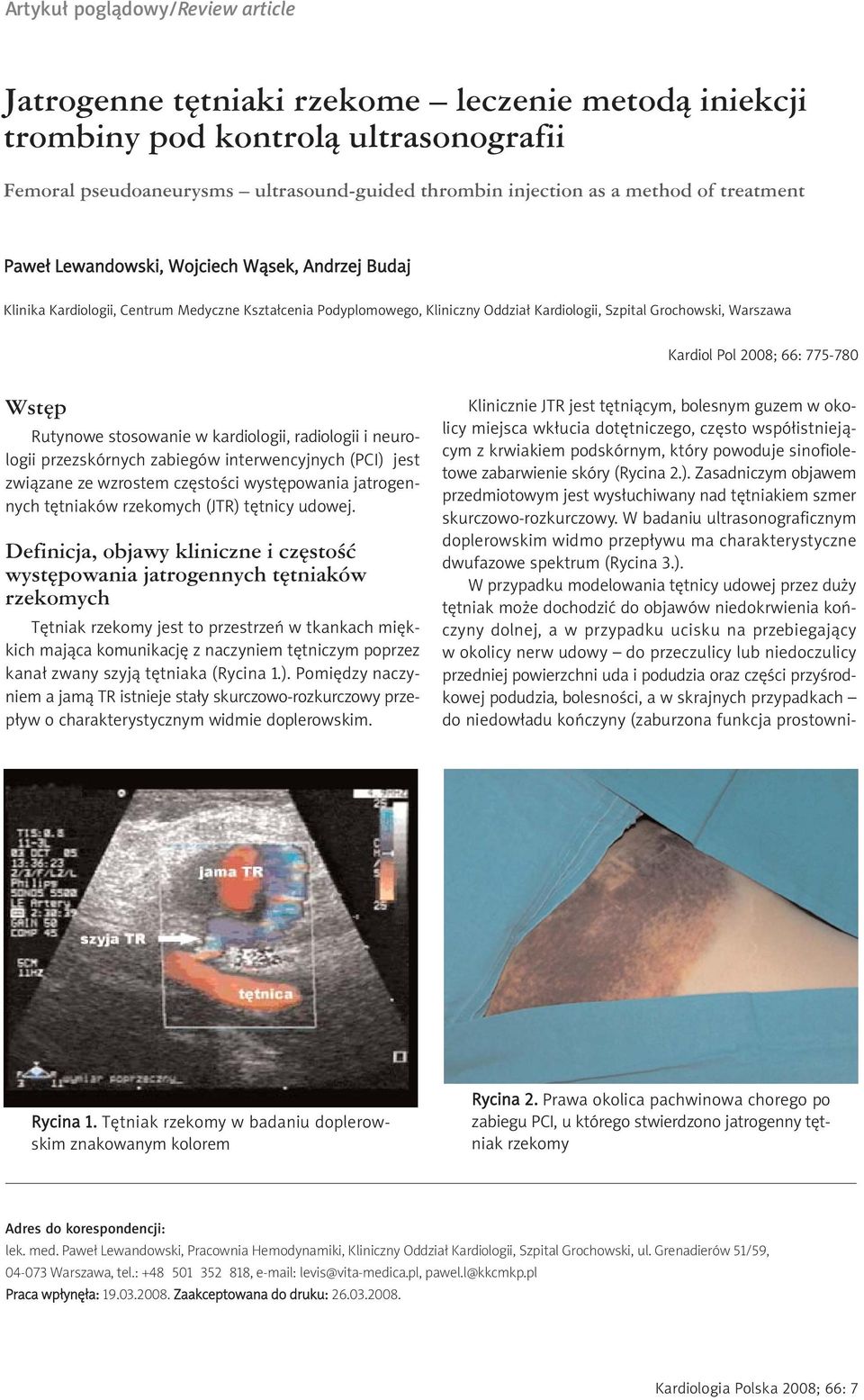 2008; 66: 775-780 Wstęp Rutynowe stosowanie w kardiologii, radiologii i neurologii przezskórnych zabiegów interwencyjnych (PCI) jest związane ze wzrostem częstości występowania jatrogennych tętniaków