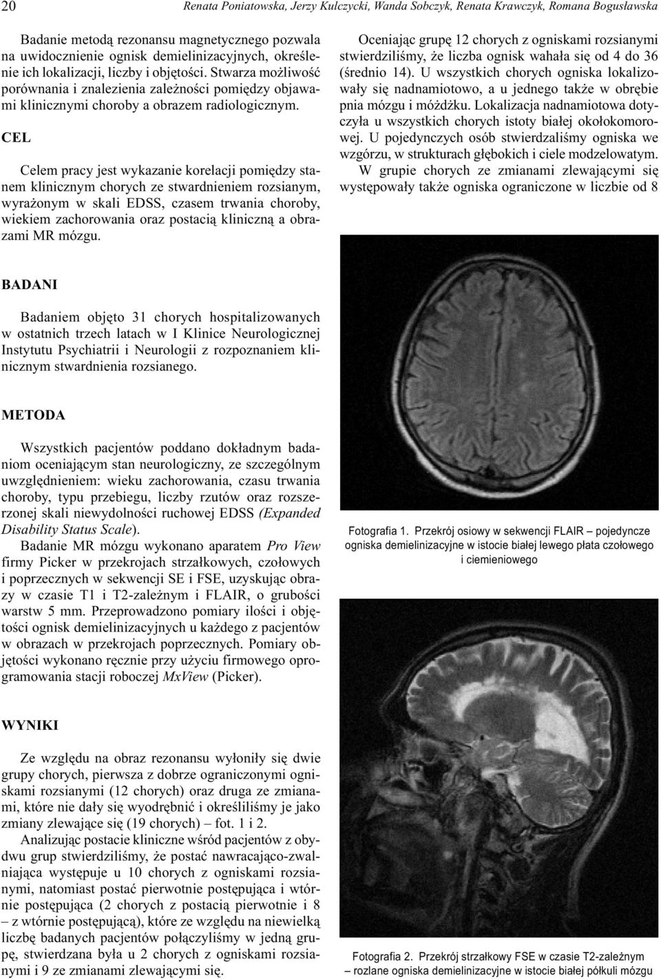 CEL Celem pracy jest wykazanie korelacji pomiêdzy stanem klinicznym chorych ze stwardnieniem rozsianym, wyra onym w skali EDSS, czasem trwania choroby, wiekiem zachorowania oraz postaci¹ kliniczn¹ a