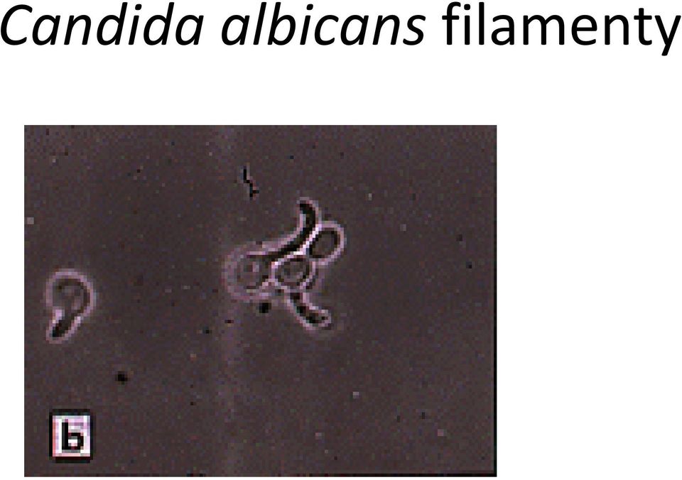 filamenty