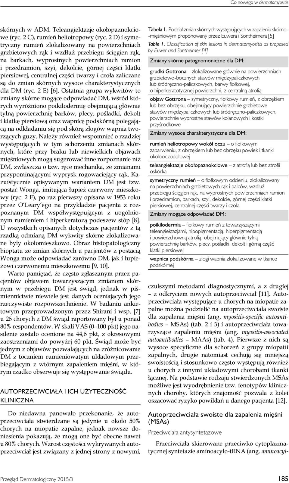 klatki piersiowej, centralnej części twarzy i czoła zaliczane są do zmian skórnych wysoce charakterystycznych dla DM (ryc. 2 E) [6].