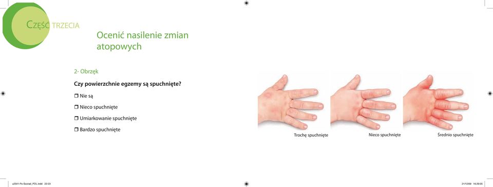 r Nie są r Nieco spuchnięte r Umiarkowanie spuchnięte r Bardzo