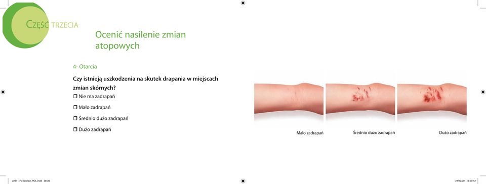 r Nie ma zadrapań r Mało zadrapań r Średnio dużo zadrapań r Dużo zadrapań