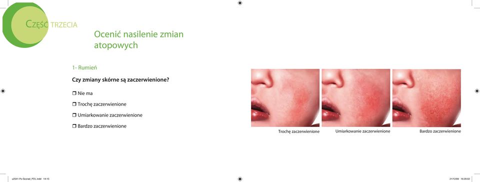 r Nie ma r Trochę zaczerwienione r Umiarkowanie zaczerwienione r Bardzo