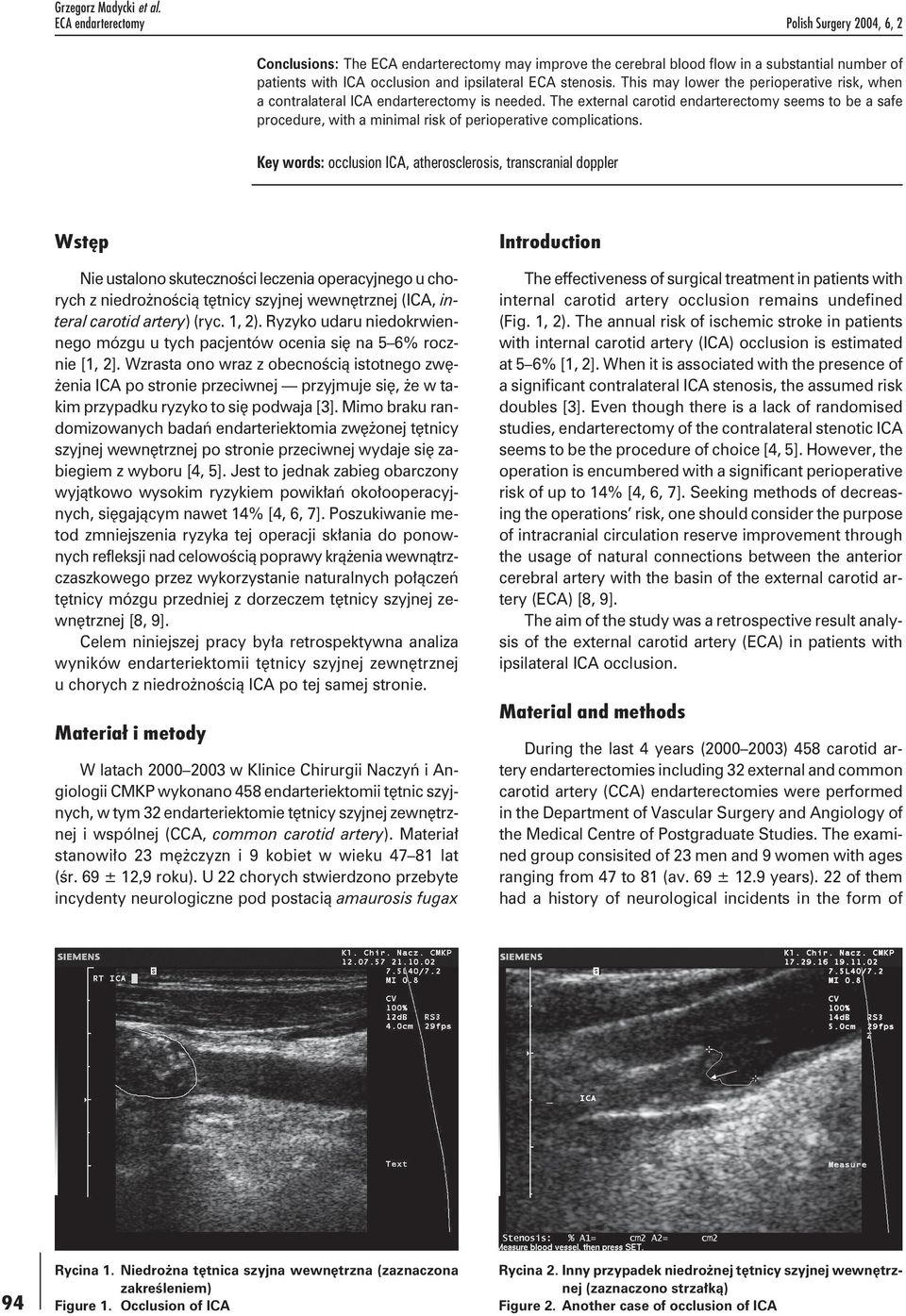 stenosis. This may lower the perioperative risk, when a contralateral ICA endarterectomy is needed.