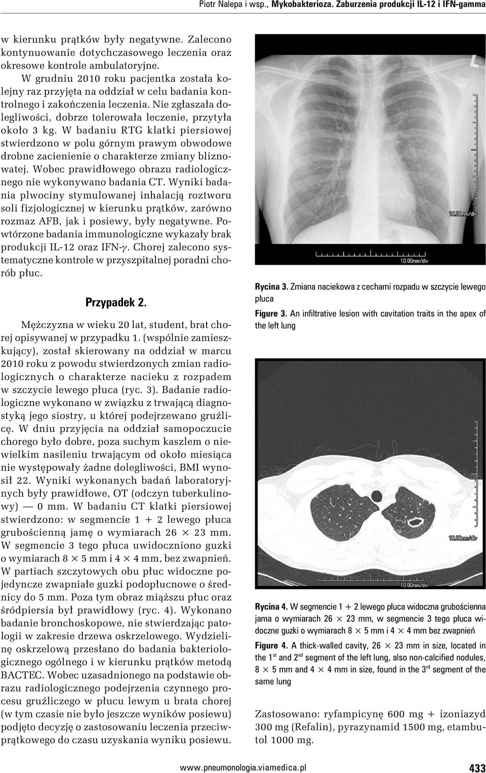 W badaniu RTG klatki piersiowej stwierdzono w polu górnym prawym obwodowe drobne zacienienie o charakterze zmiany bliznowatej. Wobec prawidłowego obrazu radiologicznego nie wykonywano badania CT.