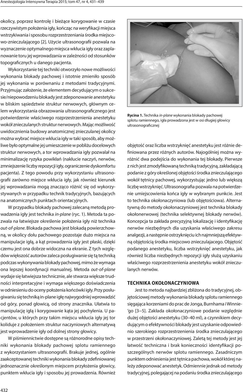 Użycie ultrasonografii pozwala na wyznaczenie optymalnego miejsca wkłucia igły oraz zaplanowanie toru jej wprowadzania w zależności od stosunków topograficznych u danego pacjenta.