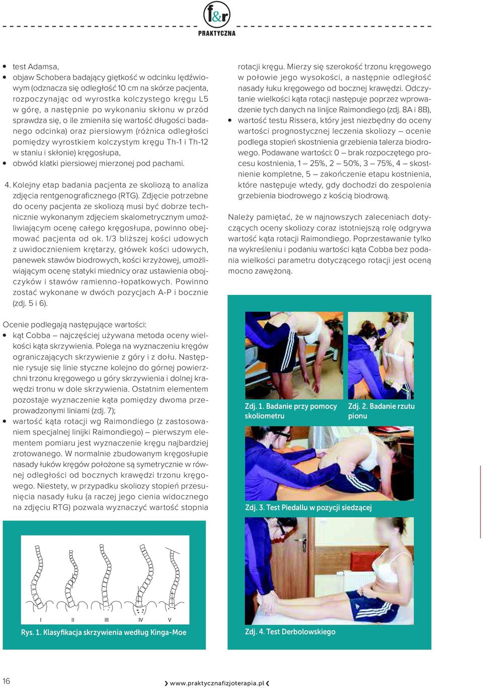 pirsiowj mirzonj pod pachami. 4. Koljny tap badania pacjnta z skoliozą to analiza zdjęcia rntgnograficzngo (RTG).