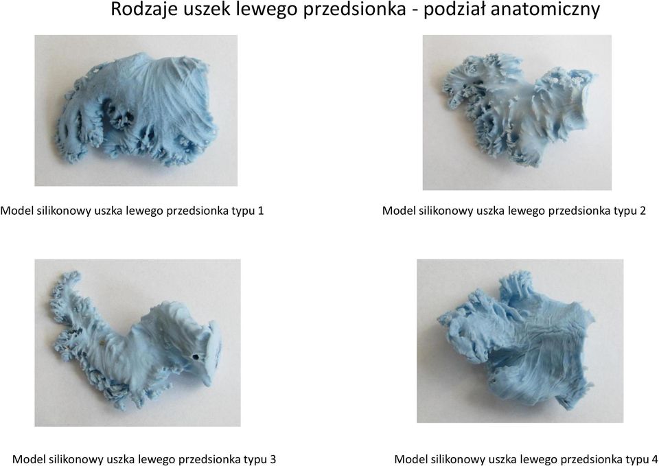 uszka lewego przedsionka typu 2 Model silikonowy uszka lewego