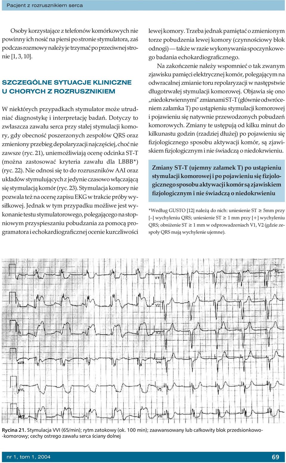 Dotyczy to zwłaszcza zawału serca przy stałej stymulacji komory, gdy obecność poszerzonych zespołów QRS oraz zmieniony przebieg depolaryzacji najczęściej, choć nie zawsze (ryc.