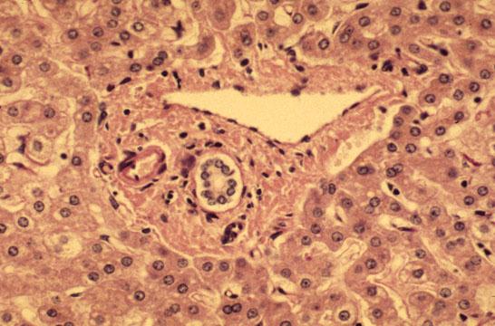 Zraziki anatomiczne Wątroba Hepatocyty w blaszkach Naczynia zatokowe Żyła centralna