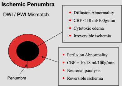 niedokrwienia Penumbra w MRI: Obszar zaburzonej perfuzji i