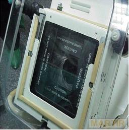 Podstawy ochrony radiologicznej w radiologii zabiegowej OSŁONA B 007 Odpowiednia kolimacja