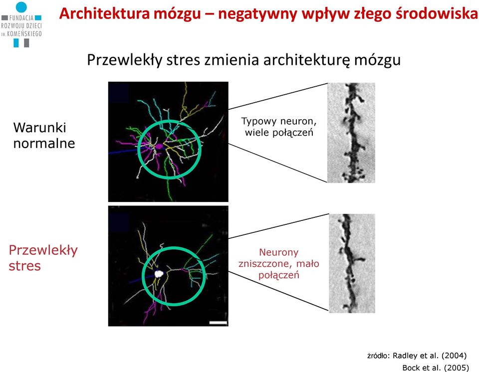 Typowy neuron, wiele połączeń Przewlekły stres Neurony
