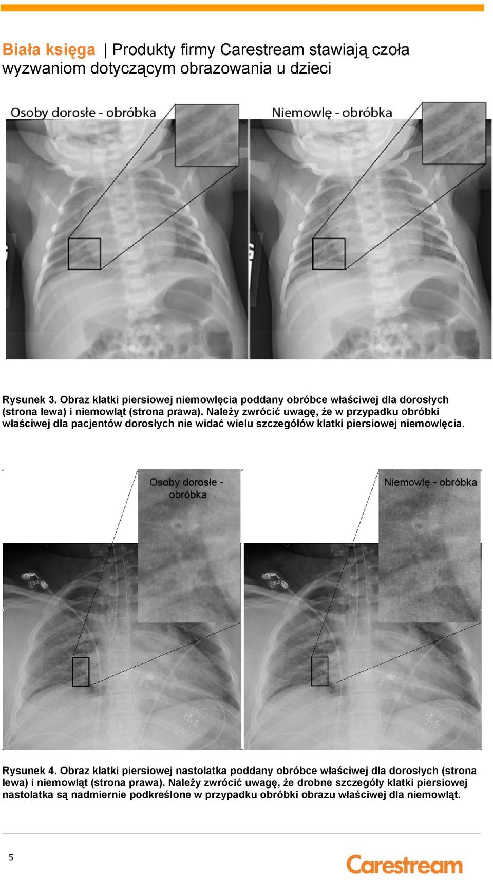 Rysunek 4. Obraz klatki piersiowej nastolatka poddany obróbce właściwej dla dorosłych (strona lewa) i niemowląt (strona prawa).